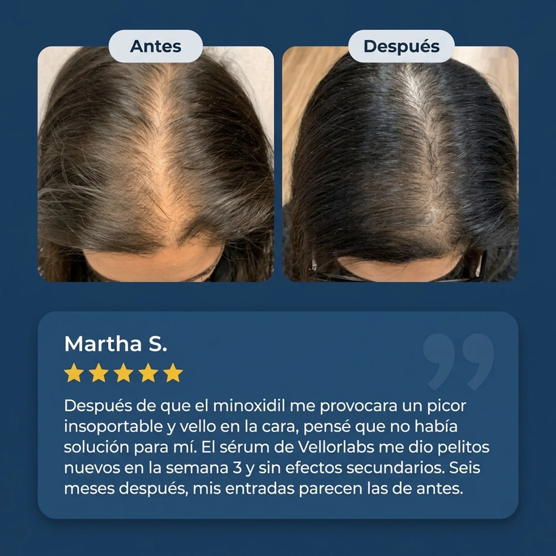 Suero Capilar BodyWise™