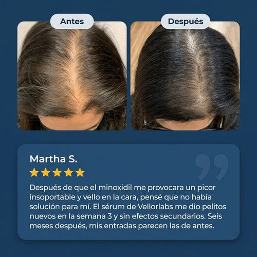 Suero Capilar BodyWise™