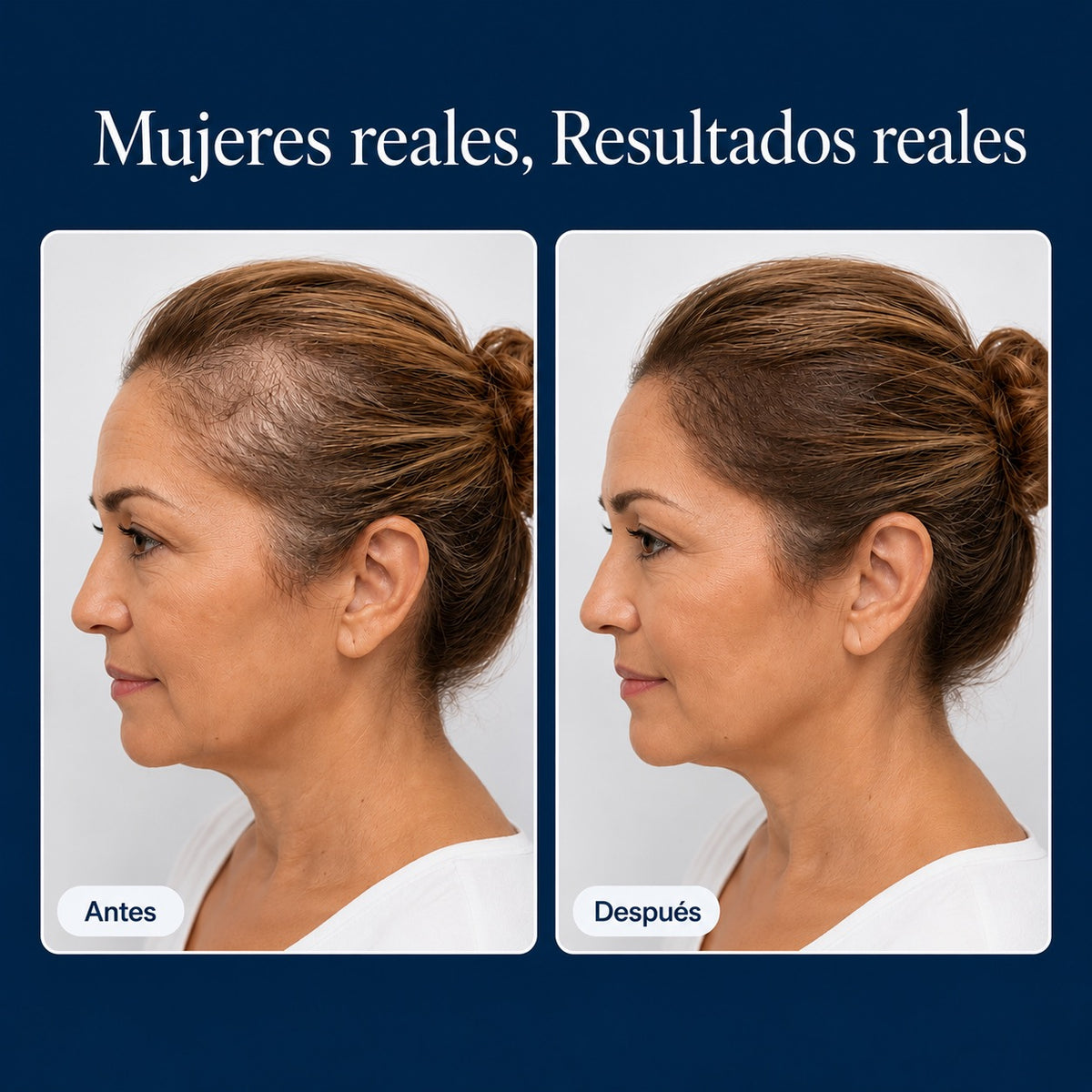 Suero Capilar BodyWise™